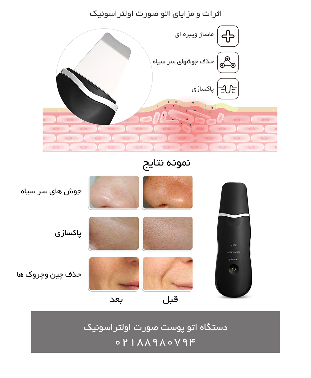 فواید دستگاه اولتراسونیک , اتوی صورت و یا درما اف دیجیتال